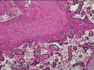 胎盘组织及部分脐带图39