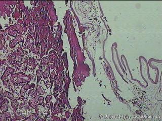 胎盘组织及部分脐带图3