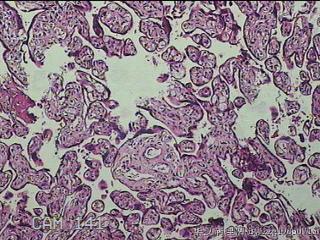 胎盘组织及部分脐带图26