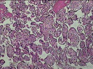 胎盘组织及部分脐带图27
