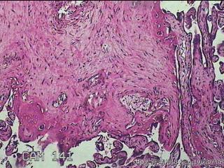 胎盘组织及部分脐带图32