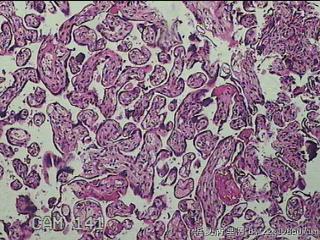 胎盘组织及部分脐带图23