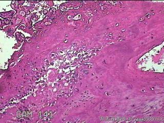 胎盘组织及部分脐带图42