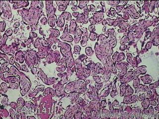 胎盘组织及部分脐带图15