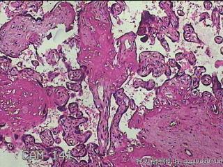 胎盘组织及部分脐带图36