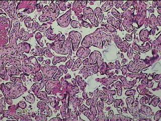 胎盘组织及部分脐带图18