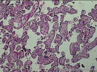 胎盘组织及部分脐带图24
