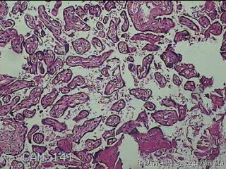 胎盘组织及部分脐带图7