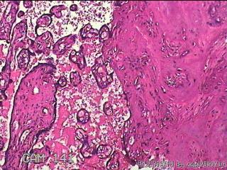 胎盘组织及部分脐带图46