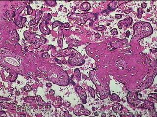 胎盘组织及部分脐带图40