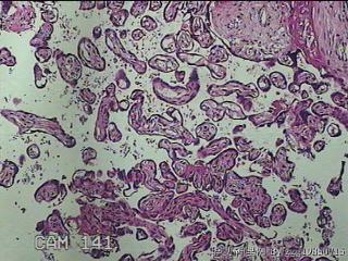 胎盘组织及部分脐带图13