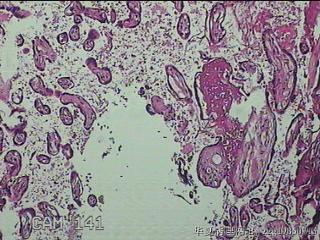 胎盘组织及部分脐带图12