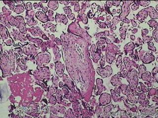 胎盘组织及部分脐带图21