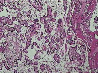 胎盘组织及部分脐带图11