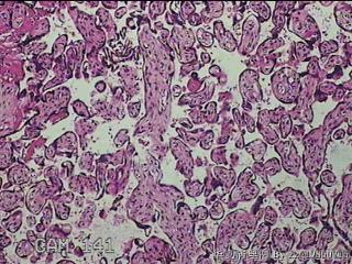胎盘组织及部分脐带图16