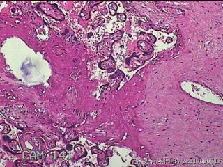 胎盘组织及部分脐带图38