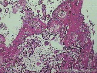 胎盘组织及部分脐带图9