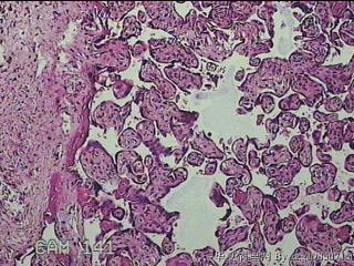 胎盘组织及部分脐带图17