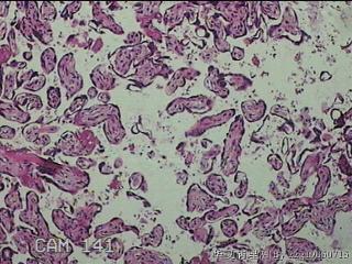 胎盘组织及部分脐带图14