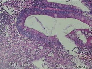 胃窦小弯侧粘膜图17