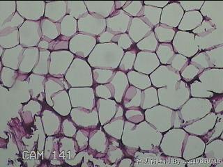 盆腔游离脂肪垂图50