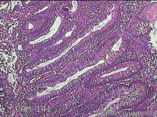 盲肠粘膜图18