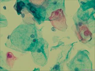 够ASC+HPV-DNA么？图13