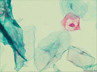 够ASC+HPV-DNA么？图1