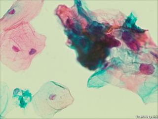 够ASC+HPV-DNA么？图8