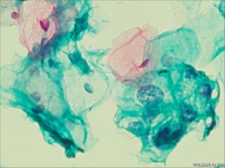 够ASC+HPV-DNA么？图5