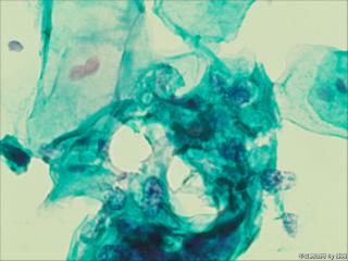 够ASC+HPV-DNA么？图6