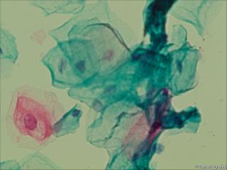 够ASC+HPV-DNA么？图10