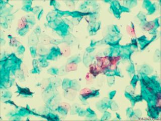 够ASC+HPV-DNA么？图13