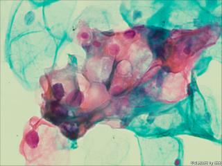 够ASC+HPV-DNA么？图1