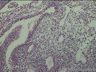 宫腔内组织图17