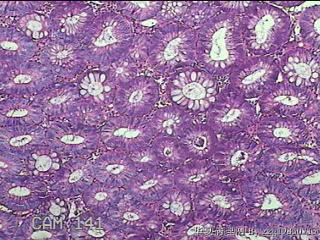 结肠粘膜图4