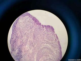 食管活检组织图8