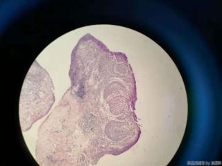 食管活检组织图6
