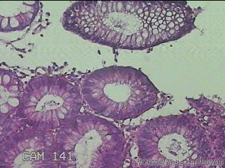 结肠粘膜图12
