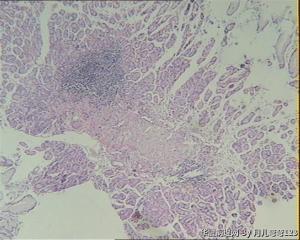 胃镜活检图13