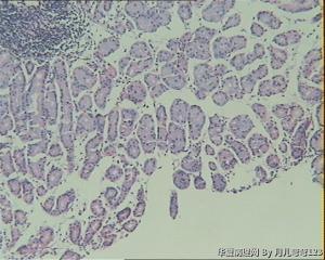 胃镜活检图9