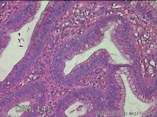 胃窦粘膜图13