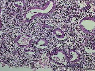 宫腔内膜组织图22