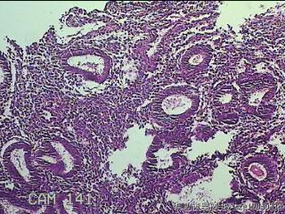 宫腔内膜组织图21