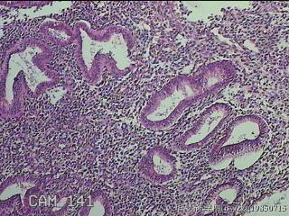宫腔内膜组织图4