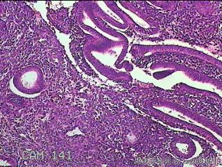 宫腔内膜组织图40