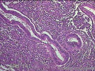 宫腔内膜组织图39