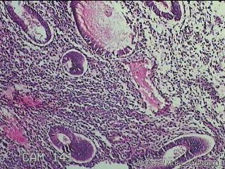 宫腔内膜组织图24