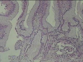 胃窦粘膜图6
