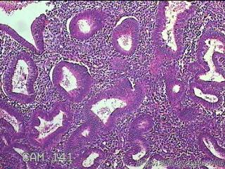 宫腔内膜组织图36